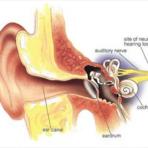 Tinnitus Cure Noise - Ringing In My Ears Won&Amp;#039;T Go Away - What Is That Ringing In My Ear And How Serious Can It Be?