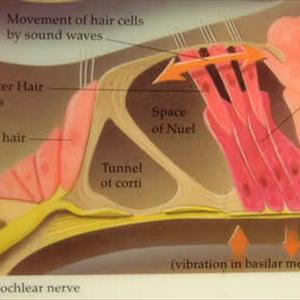 Tinnitus Support - Tinnitus Treatment: Finding The Right Method To Stop The Ringing In Your Ears