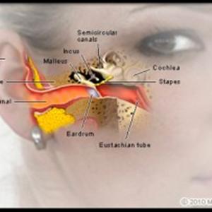 Tinnitus Getting Worse - Tinnitus Adult  All Natural Remedies - An Outline Physicans Refuse To Tell You